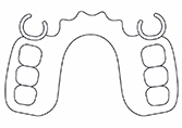 義歯（入れ歯）